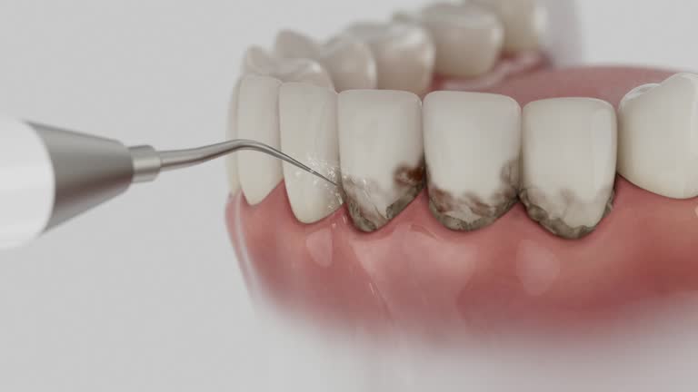 Trusted Dental Crowns And Bridges service in Sulligent, AL - Dentist Open Now